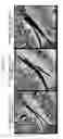 Fig. 31 - Nanocarriers and their processing for diagnostics and therapeutics