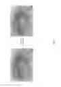 Fig. 06 - Medicament for treating peripheral neuropathies