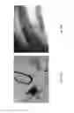 Fig. 19 - Medicament for treating peripheral neuropathies