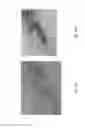 Fig. 22 - Medicament for treating peripheral neuropathies