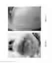 Fig. 24 - Medicament for treating peripheral neuropathies