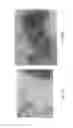Fig. 31 - Medicament for treating peripheral neuropathies