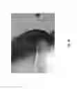Fig. 37 - Medicament for treating peripheral neuropathies