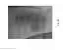 Fig. 41 - Medicament for treating peripheral neuropathies