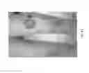 Fig. 44 - Medicament for treating peripheral neuropathies