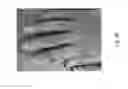 Fig. 49 - Medicament for treating peripheral neuropathies