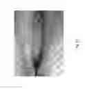 Fig. 52 - Medicament for treating peripheral neuropathies