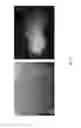 Fig. 53 - Medicament for treating peripheral neuropathies