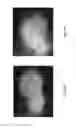 Fig. 55 - Medicament for treating peripheral neuropathies