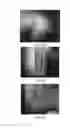 Fig. 58 - Medicament for treating peripheral neuropathies