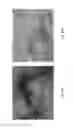 Fig. 59 - Medicament for treating peripheral neuropathies
