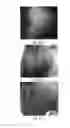 Fig. 60 - Medicament for treating peripheral neuropathies