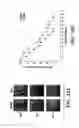 Fig. 38 - Method of Treating or Preventing Pathologic Effects of Acute Increases in Hyperglycemia and/or Acute Increases of Free Fatty Acid Flux