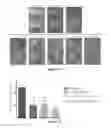 Fig. 13 - USE OF HYDROGEN SULFIDE TO PREVENT LENS OPACIFICATION