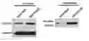 Fig. 01 - NOVEL BIOMARKER FOR DIAGNOSING RESISTANCE TO ANTICANCER AGENT FOR BILLARY TRACT CANCER AND USE THEREOF