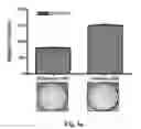Fig. 06 - NOVEL BIOMARKER FOR DIAGNOSING RESISTANCE TO ANTICANCER AGENT FOR BILLARY TRACT CANCER AND USE THEREOF