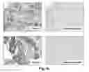 Fig. 09 - NOVEL BIOMARKER FOR DIAGNOSING RESISTANCE TO ANTICANCER AGENT FOR BILLARY TRACT CANCER AND USE THEREOF