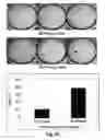 Fig. 13 - NOVEL BIOMARKER FOR DIAGNOSING RESISTANCE TO ANTICANCER AGENT FOR BILLARY TRACT CANCER AND USE THEREOF