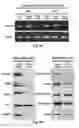 Fig. 14 - NOVEL BIOMARKER FOR DIAGNOSING RESISTANCE TO ANTICANCER AGENT FOR BILLARY TRACT CANCER AND USE THEREOF