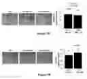 Fig. 11 - Micro-RNA for the treatment of malignant solid tumors and metastasis