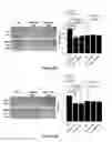 Fig. 13 - Micro-RNA for the treatment of malignant solid tumors and metastasis