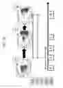 Fig. 12 - Anti third party central memory T cells, methods of producing same and use of same in transplantation and disease treatment