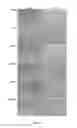 Fig. 07 - Amniotic membrane preparations and purified compositions and therapy for scar reversal and inhibition