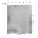 Fig. 11 - Amniotic membrane preparations and purified compositions and therapy for scar reversal and inhibition