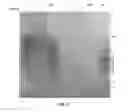 Fig. 12 - Amniotic membrane preparations and purified compositions and therapy for scar reversal and inhibition