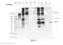 Fig. 13 - Amniotic membrane preparations and purified compositions and therapy for scar reversal and inhibition