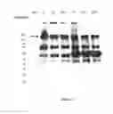 Fig. 14 - Amniotic membrane preparations and purified compositions and therapy for scar reversal and inhibition