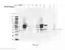 Fig. 17 - Amniotic membrane preparations and purified compositions and therapy for scar reversal and inhibition