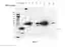 Fig. 18 - Amniotic membrane preparations and purified compositions and therapy for scar reversal and inhibition