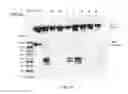 Fig. 20 - Amniotic membrane preparations and purified compositions and therapy for scar reversal and inhibition