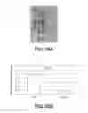 Fig. 29 - Amniotic membrane preparations and purified compositions and therapy for scar reversal and inhibition