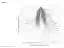 Fig. 04 - INDUCTION OF LAMINA PROPRIA REGULATORY T CELLS