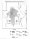 Fig. 02 - COMPOSITION FOR TREATMENT OF RSV