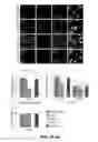 Fig. 06 - Methods and agents for treating Alzheimer's disease