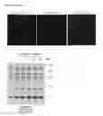 Fig. 32 - Methods for identification, assessment, prevention, and treatment of metabolic disorders using Slit2
