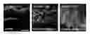 Fig. 01 - Compositions, kits, and methods using interleukin-17C to promote neural growth and/or neural survival