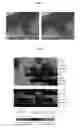 Fig. 04 - Compositions, kits, and methods using interleukin-17C to promote neural growth and/or neural survival