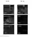 Fig. 07 - Compositions, kits, and methods using interleukin-17C to promote neural growth and/or neural survival