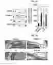 Fig. 13 - Peptide for promoting bone formation or inhibiting bone resorption and use thereof