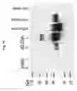 Fig. 20 - NOVEL MUCOSAL VACCINATION APPROACH FOR HERPES SIMPLEX VIRUS TYPE-2