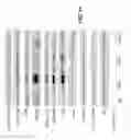 Fig. 22 - COMPOSITIONS AND METHODS FOR TREATING SENESCENCE-ASSOCIATED DISEASES AND DISORDERS