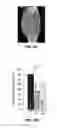 Fig. 99 - COMPOSITIONS AND METHODS FOR TREATING SENESCENCE-ASSOCIATED DISEASES AND DISORDERS