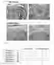 Fig. 22 - Gene/carrier complex for preventing or treating inflammatory diseases
