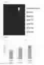 Fig. 23 - Gene/carrier complex for preventing or treating inflammatory diseases
