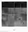 Fig. 09 - Nanoparticle composition for use in targeting cancer stem cells and method for treatment of cancer