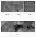 Fig. 17 - Nanoparticle composition for use in targeting cancer stem cells and method for treatment of cancer